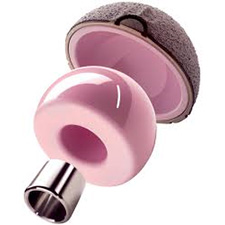 Total Hip Replacement